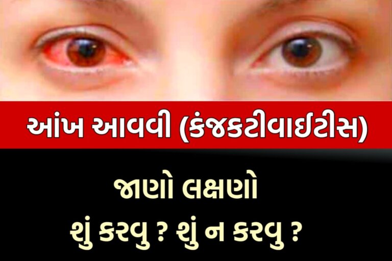 કન્જકટીવાઇટીસ