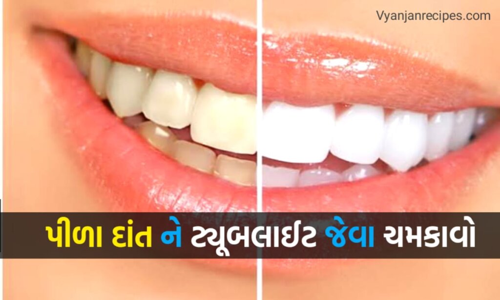 પીળા દાંત સફેદ કરવા માટે